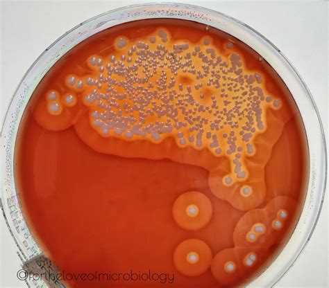 Blood Agar Staphylococcus Aureus