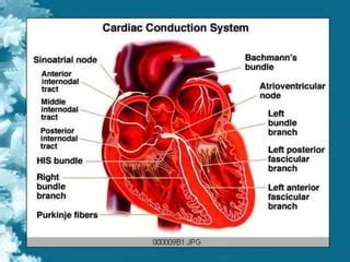 PENYAKIT JANTUNG KORONER Ppt