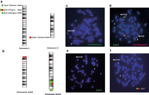 FISH on chromosomes 2 and 12 implicated in the balanced translocation.... | Download Scientific ...