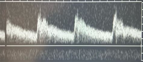 Physics Study Material Doppler Instrumentation And Hemodynamics