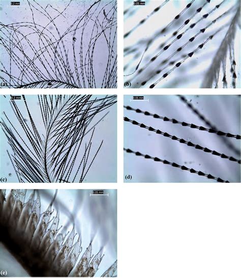 Photomicrographs of downy barbules from New Zealand birds examined: (a ...