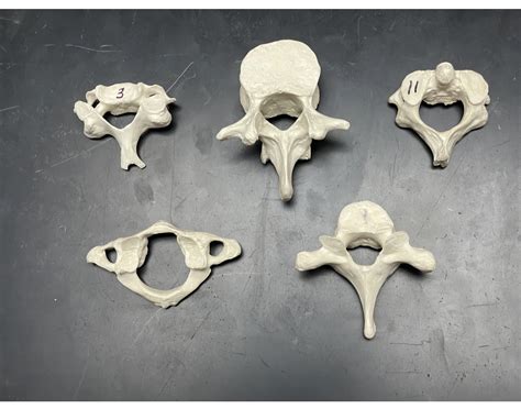 Types of Vertebrae Quiz