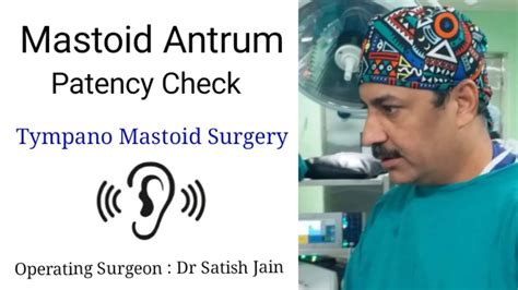 Mastoid Antrum Patency Test DrSatishJain 4K Ear Surgery YouTube