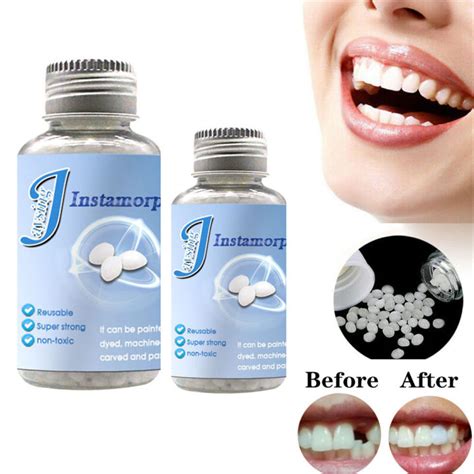 Diy Replace Missing Denture Repair Dental Decorative Denture Denture