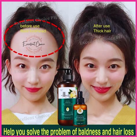 Hair Growth Serum Ginger Hair Care Essence Anti Hair Loss Fast Hair