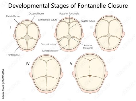 Developmental Stages Of Fontanelle Closure In Infants Detailing