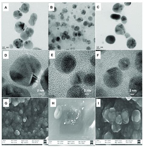 Hrtem Images Of A C Agnps Znonps And Ag Znonps At Nm Scale View