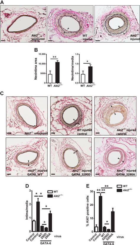 Gata 6 Expression Attenuates Neointima Formation In The Mouse Download Scientific Diagram