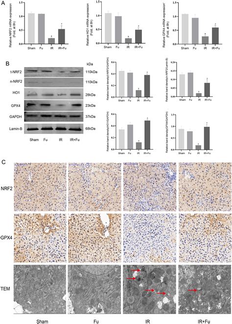 Fucoidan Ameliorates Ferroptosis In Ischemia Reperfusion Induced Liver