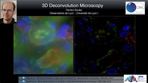 3D Deconvolution Microscopy YouTube