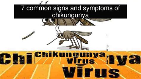 7 Common Signs And Symptoms Of Chikungunya Youtube