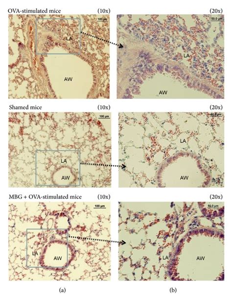 Histopathological Observations Of The Pulmonary Tissues Obtained From