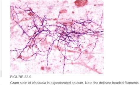 Exam Lect G Bacilli Listeria Corynebacterium Nocardia