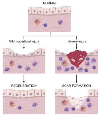 Regeneración de inflamación