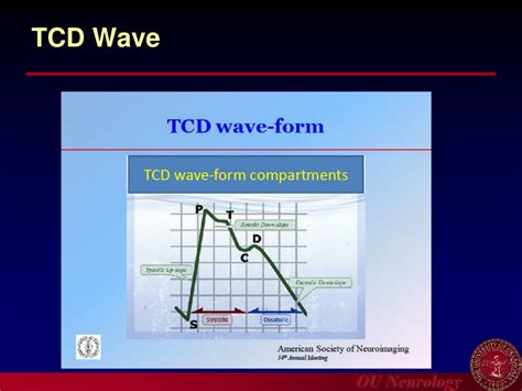 Ppt Introduction To Carotid Ultrasound And Transcranial Doppler