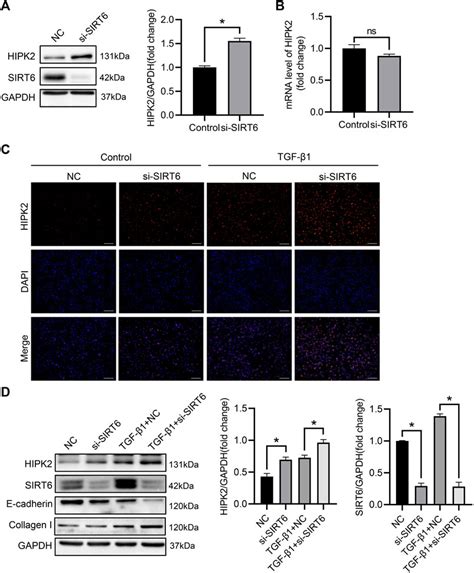 Frontiers Sirt Overexpression Retards Renal Interstitial Fibrosis