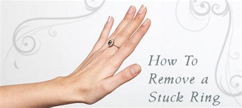 How To Remove a Stuck Ring