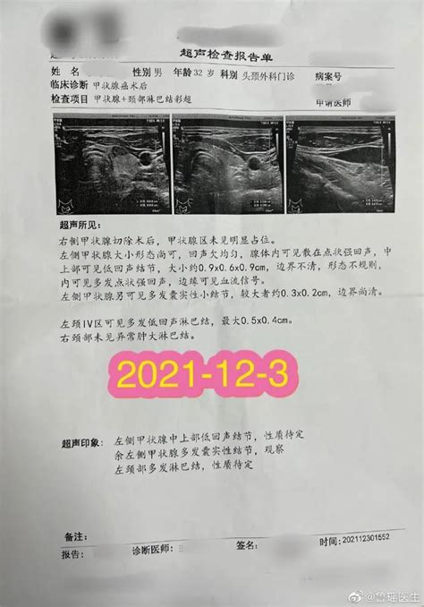 甲状腺癌“半切”术后4个月，复查结果让患者“进退两难”！腾讯新闻