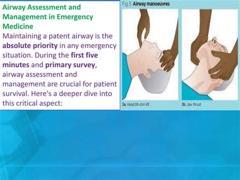 Airway Assessment And Management In Emergency Medicinent Pdf