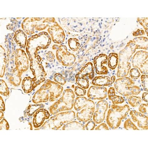 Vdac2 Antibody Affinity Biosciences Ltd亲科生物官网