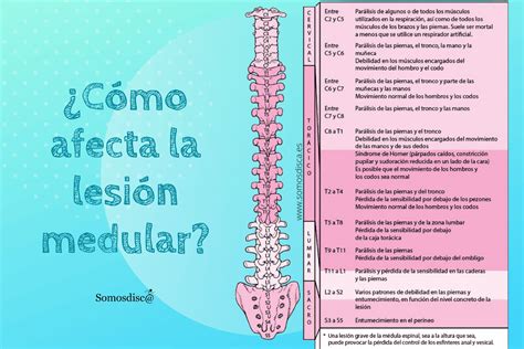 Niveles Y Tipos De Lesion Medular Nbkomputer