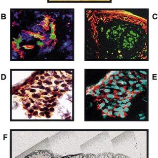 Microscopic Spectral Imaging Analysis Of Atypical Nevus Specimens A