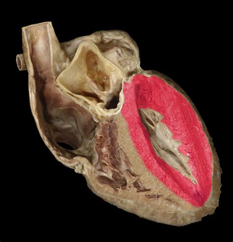 Heart APR LAB PRACTICAL 1 Flashcards Quizlet