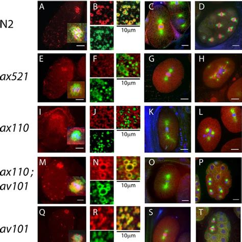 Subcellular Localization Of Sep 1 Is Defective In Mutants Wild Type