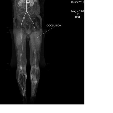 SPIN RADIOGRAPHERS: Contrast-enhanced MR angiography of abdominal aorta and lower extremity