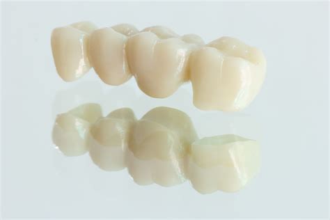 Zirconia Fixed Bridges Dental Crowns Veneers Cosmetic Dentist