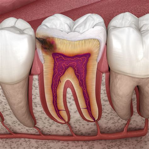 Virudent Hambaravi Virudent Hambaravi