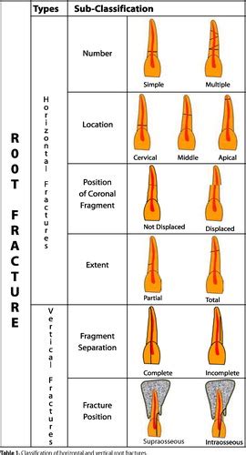 Tooth Fracture Classification