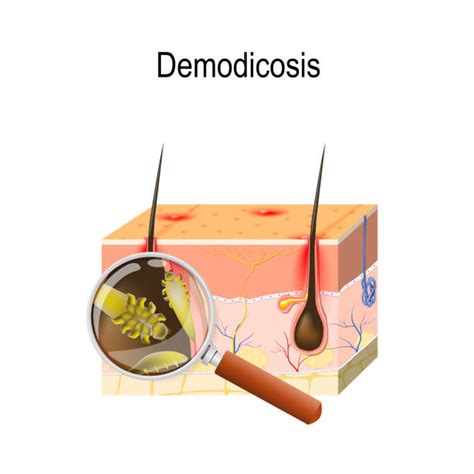 30 Demodex Illustrations Stock Illustrations Royalty Free Vector Graphics And Clip Art Istock