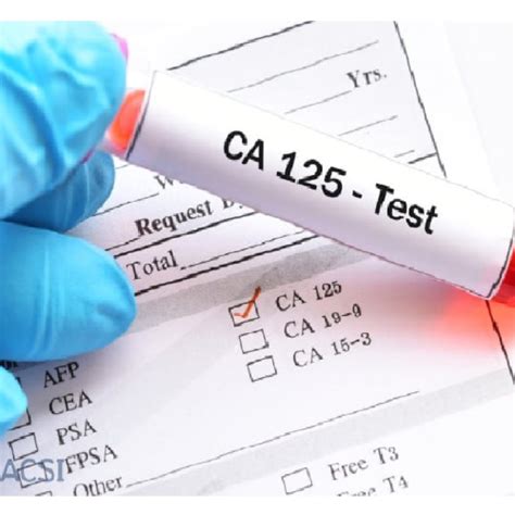 Ovarian Cancer- CA 125 (OV) Test 1S - Pharma Xonline