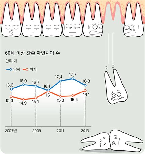 치매까지 부르는 치아상실 틀니만 해도 위험 줄인다 중앙일보