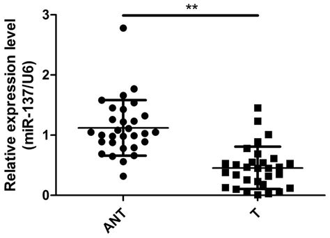 MiR 137 Acts As A Tumor Suppressor In Papillary Thyroid Carcinoma By