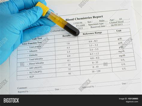 Liver Function Test Normal Values