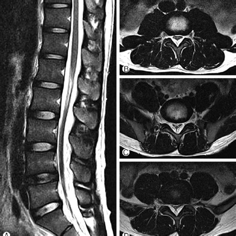 Sagittal And Axial T Weighted Images Of The Magnetic Resonance Image