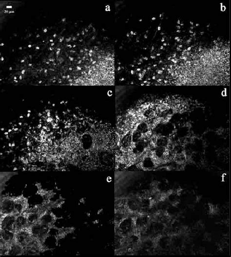 Images Of A Normal Tissue Area In A Nude Mouse After The Application