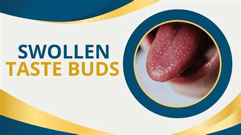 Swollen Taste Buds 6 Signs And Symptoms And Their Cure Youtube