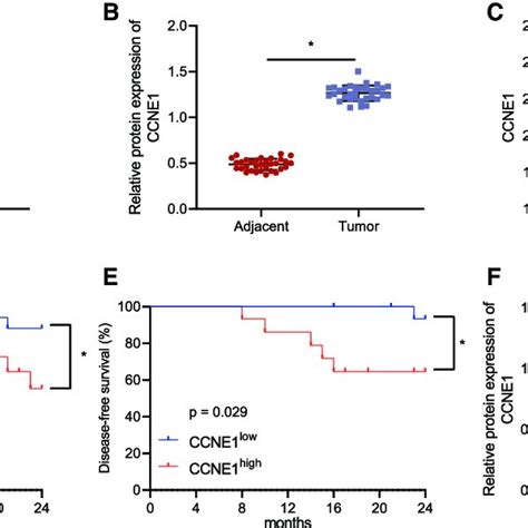 Ccne1 Is Highly Expressed In Wilms Tumor Tissues And Cells A Qrt Pcr