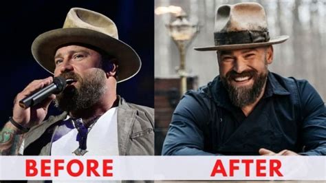 Zac Brown Weight Loss 2024 Diet Workout Before And After