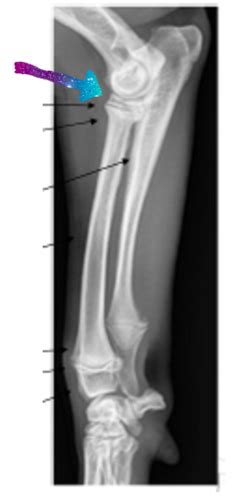 Musculoskeletal Imaging Bone Pathology Flashcards Quizlet