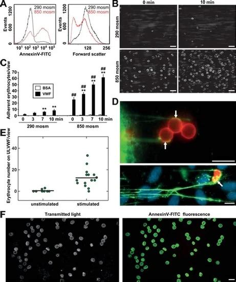 Visualize Leukocyte Adhesion In Real Time With Bioflux