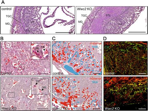 Defects In Placenta Organization And Impaired Labyrinth Vascularization