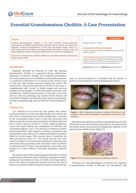 (PDF) Essential Granulomatous Cheilitis: A Case Presentation