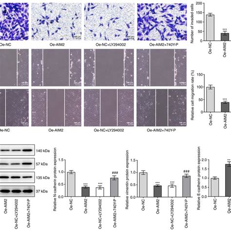 Aim2 Overexpression Inhibits The Invasion Migration And Emt Of Download Scientific Diagram