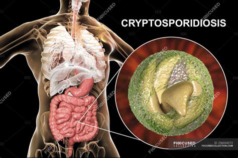 Parasite In Human Body