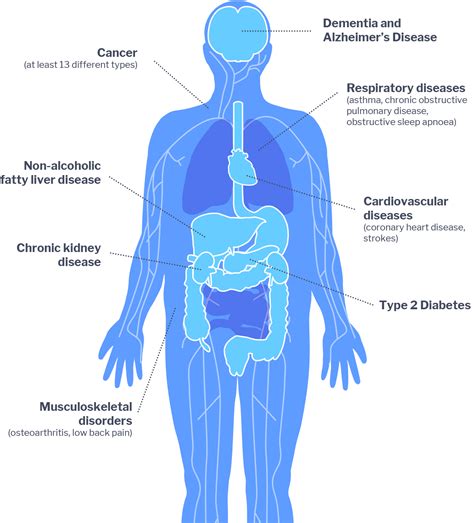 Health impacts of obesity | Obesity Evidence Hub