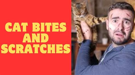 Cat Bites And Scratches What To Do And How To Prevent Them Youtube